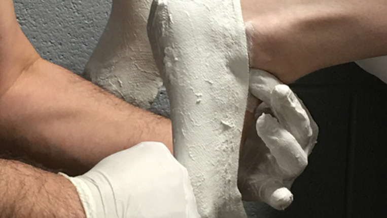 plastercasting